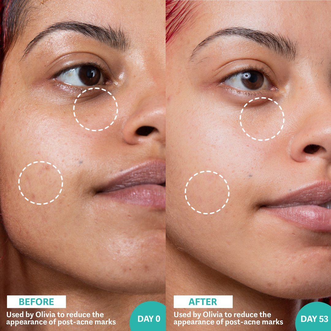Retinol & Rainbow Algae Repair Serum~ Selfless by Hyram