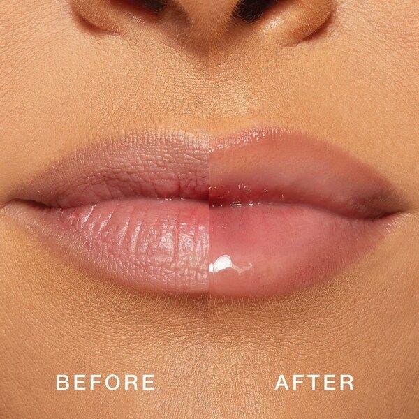 Forget The Filler Lip Plumping~ Lawless